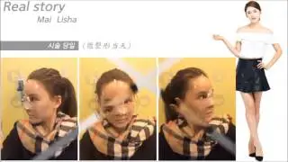 에스프로포즈성형외과 리얼스토리