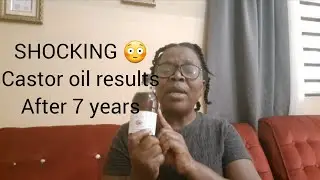 I used castor oil for seven years straight, and this happened