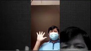 mostrando el lado de mi microtia (pruebas mas concretas-y que tengan un hermozo dia)