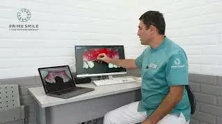 Как проводят костную пластику челюсти после аварии