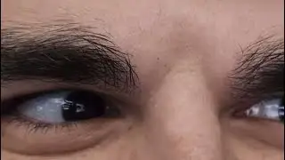 Foolish's eyes