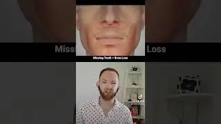 Missing Teeth = Bone Loss