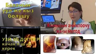 УЗИ, 3D, ДОПЛЕРге качан түшүш керек? Баланын жынысын аныктоочу жаңы метод!