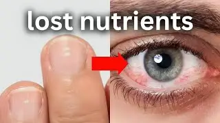 all nofap benefits you lose after relapse (complete guide)