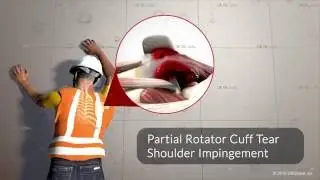 Tractor Smashes Construction Worker's Leg