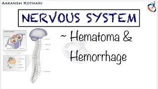 Types of Hematoma and Hemorrhage | Nervous System Pathology