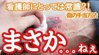 【こどもの手当】湿潤療法について解説する