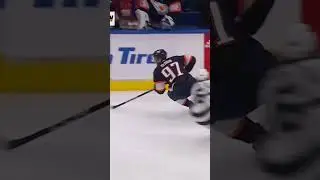 CONNOR MCDAVID GOT INJURY? #hockey #shorts