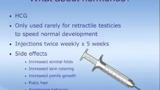 Cryptorchidism (Undescended Testicle)