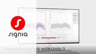 Speech mapping with Percentile Analysis in Unity 3 | Signia Hearing Aids