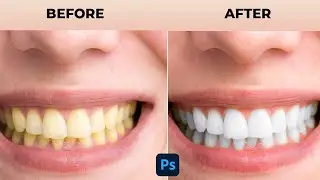 Learn How to White Teeth in Photoshop CC | Adobe Photoshop CC | 