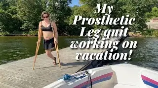 My Experience When My Otto Bock Genium X3 knee and Limblogic broke!