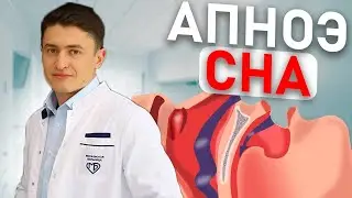 Храп. Апноэ сна. Классификация