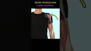 Fix Front Shoulder Pain. (Biceps Tendonitis)