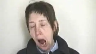 The Yawning