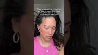 Send some hair growth tips my way 😩 #hair #hairloss