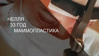 Врач сказал "четверочку". Маммопластика Нэлли