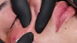 This is my clients very first facial