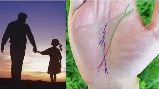 СМЕРТЬ ОТЦА НА ЛАДОНИ ДОЧЕРИ. Хирообзор.