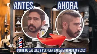 corte de cabello y perfilar barba minoxidil 8 meses