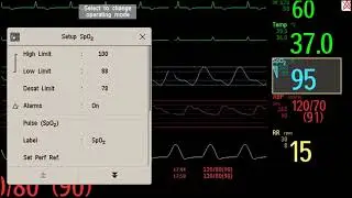 Philips IntelliVue Patient Monitoring   Basic Operation