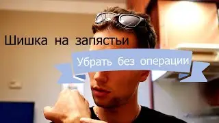 Как убрать шишку на запястьи ? 2020 Без операций