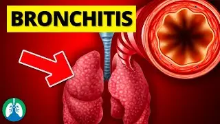 Bronchitis (Medical Definition) | Quick Explainer Video