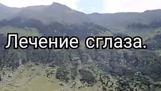 53)Лечение сглаза.