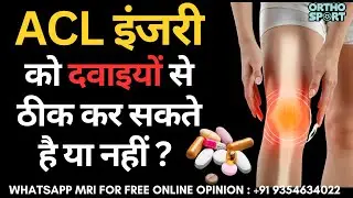 ACL Ligament इंजरी को दवाइयों से ठीक कर सकते है या नहीं  | Medicine for ACL Injury Treatment