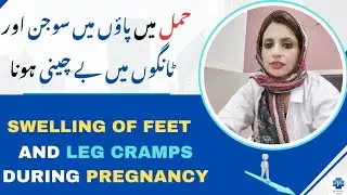 Swelling Of Feet And Leg Cramps During Pregnancy | حمل میں پاؤں میں سوجن اور ٹانگوں میں بے چینی ہونا