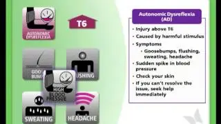 SCI-U: Skin - Part 5 (Autonomic Dysreflexia [A.D] and Problem Solving)