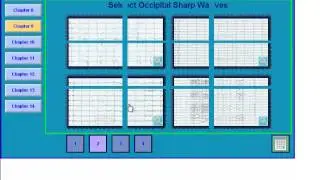 EEG in Epilepsy