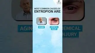 Weight Loss & Eye Problems: Entropion Causes Rapid Weightloss | 
