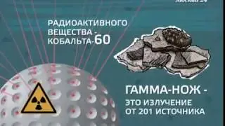 Каковы симптомы опухоли головного мозга - Телеканал "Москва 24"