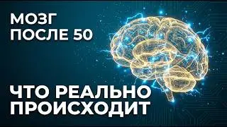 Forgetfulness After 50 Isn't Age. Here's What's Really Happening