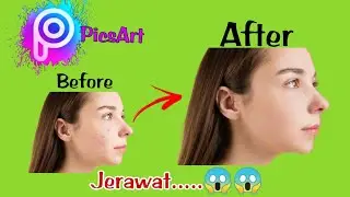 Cara menghilangkan jerawat pakai aplikasi PICSART || Edit foto Android