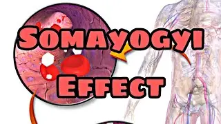 The Somogyi phenomenon|knowledge madnoob