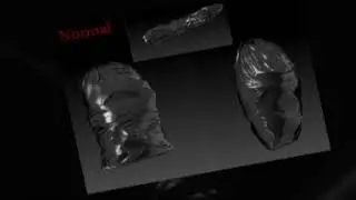 trashvidEO