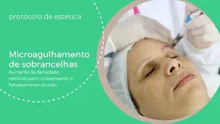 Protocolo Microagulhamento de sobrancelhas