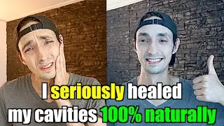 Try THIS for Cavities BEFORE you get that Operation 🦷