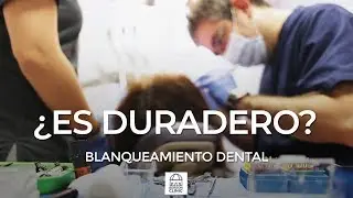 ¿Cuánto dura el blanqueamiento dental?