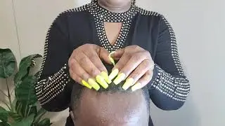 ASMR Scalp Scratching Sounds With Long Nails, Fast, Rough,💦 No Talking 😴💤