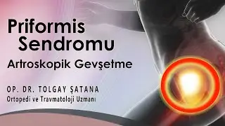 Kalça Protezinden Sonra Gelişen  Priformis Sendromuna Artroskopik Gevşetme