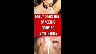 Signs that Cancer is growing in your body