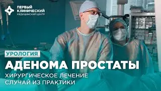 Лечение аденомы предстательной железы. Случай из практики.