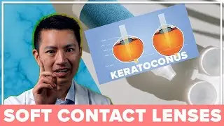 Can I Wear Soft Contact Lenses For Keratoconus?