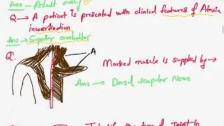 NEET PG 2020 - 150+ SOLVED QUESTIONS