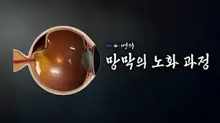 [명의 의학백과📖] 망막의 노화 과정