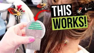 Lice Terminator Comb - Lice Removal Comb | উকুনের চিরুনি |  লাইস রিমুভার লাইস টার্মিনেটর