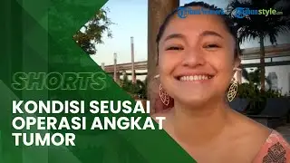 Kondisi Terkini Artis Marshanda seusai Jalani Operasi Pengankatan Tumor Payudara